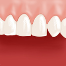 La dentition est parfaite !