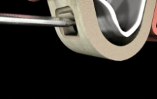 Accès au sinus maxillaire