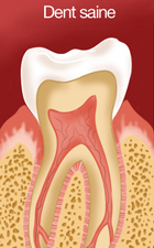 Dent saine